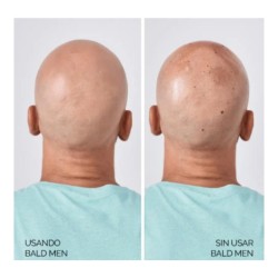 SOIVRE BALD MEN SPRAY CUIDADO CAPILAR CALVOS Y RAPADOS SPF 50 100 ML
